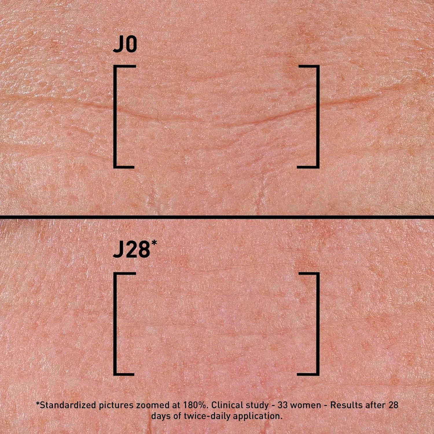 Filorga Time-Filler Intensive 5XP Correcting Serum 30ml