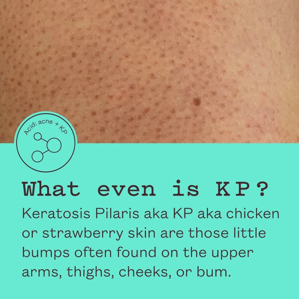 Frank Body Glycolic Body Scrub 250g