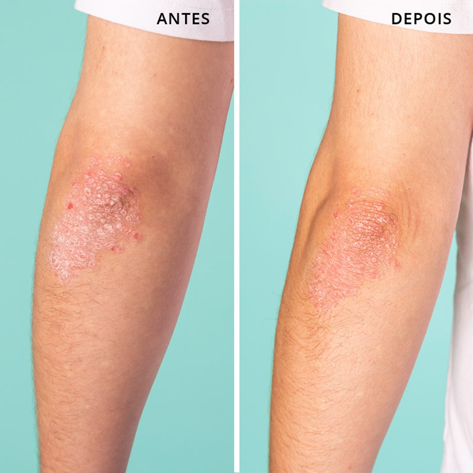 Freshly Cosmetics Skin Rescue All-Purpose Balm 40ml
