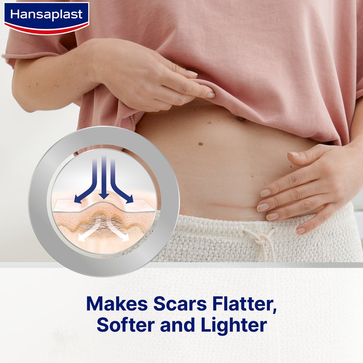 Hansaplast Scar Reducer Self-Adhesive Patches