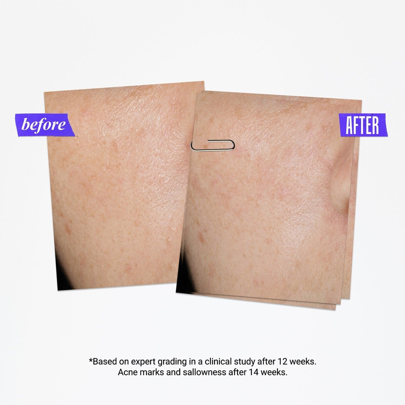 Kiehl's Clearly Corrective Dark Spot Solution 50ml