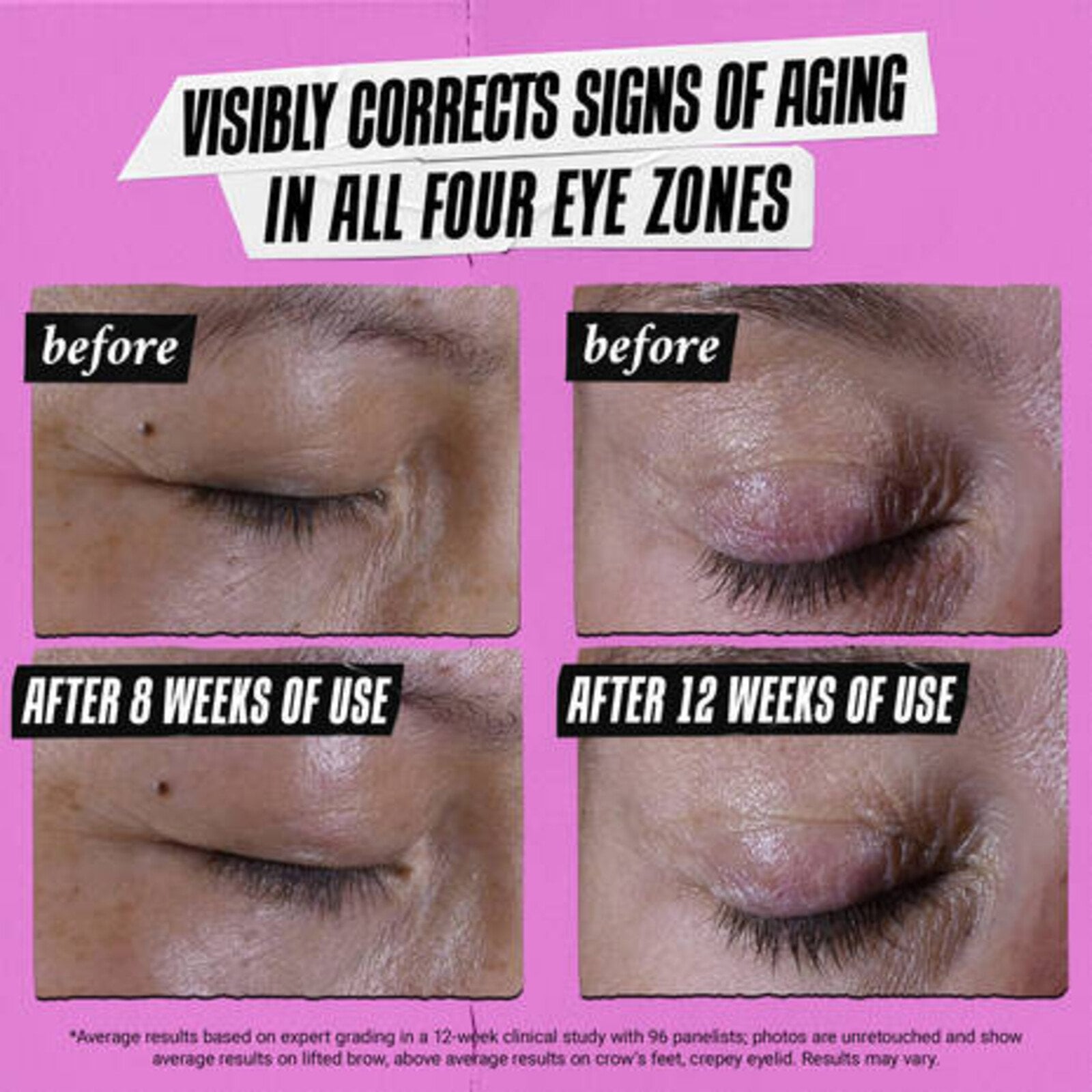 Kiehl's Super Multi-Corrective Eye Zone Treatment 28ml