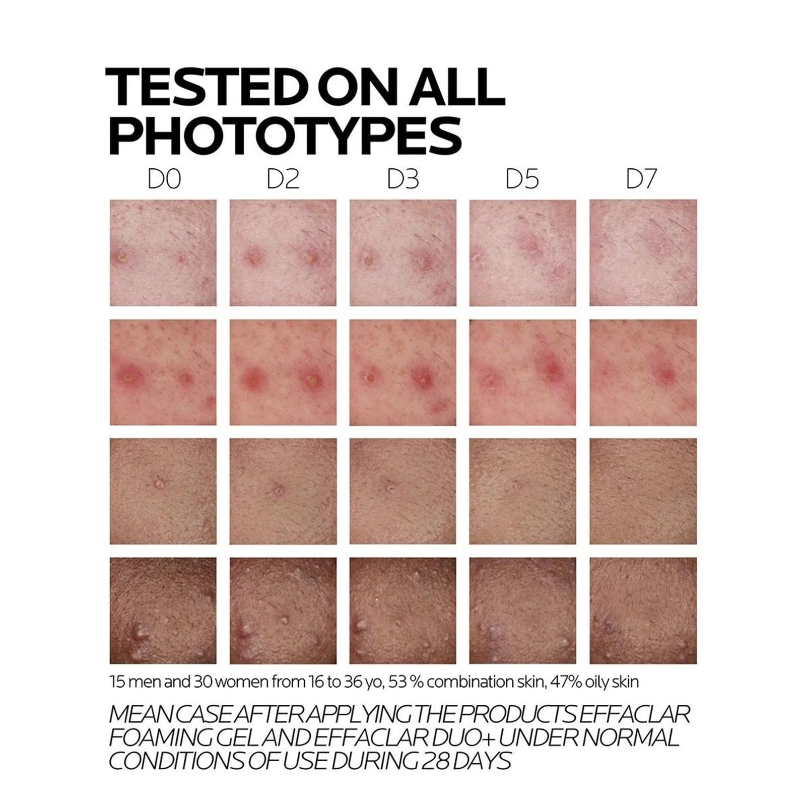 La Roche-Posay Effaclar Duo+M Anti-Blemish Corrective Gel Moisturizer 40ml