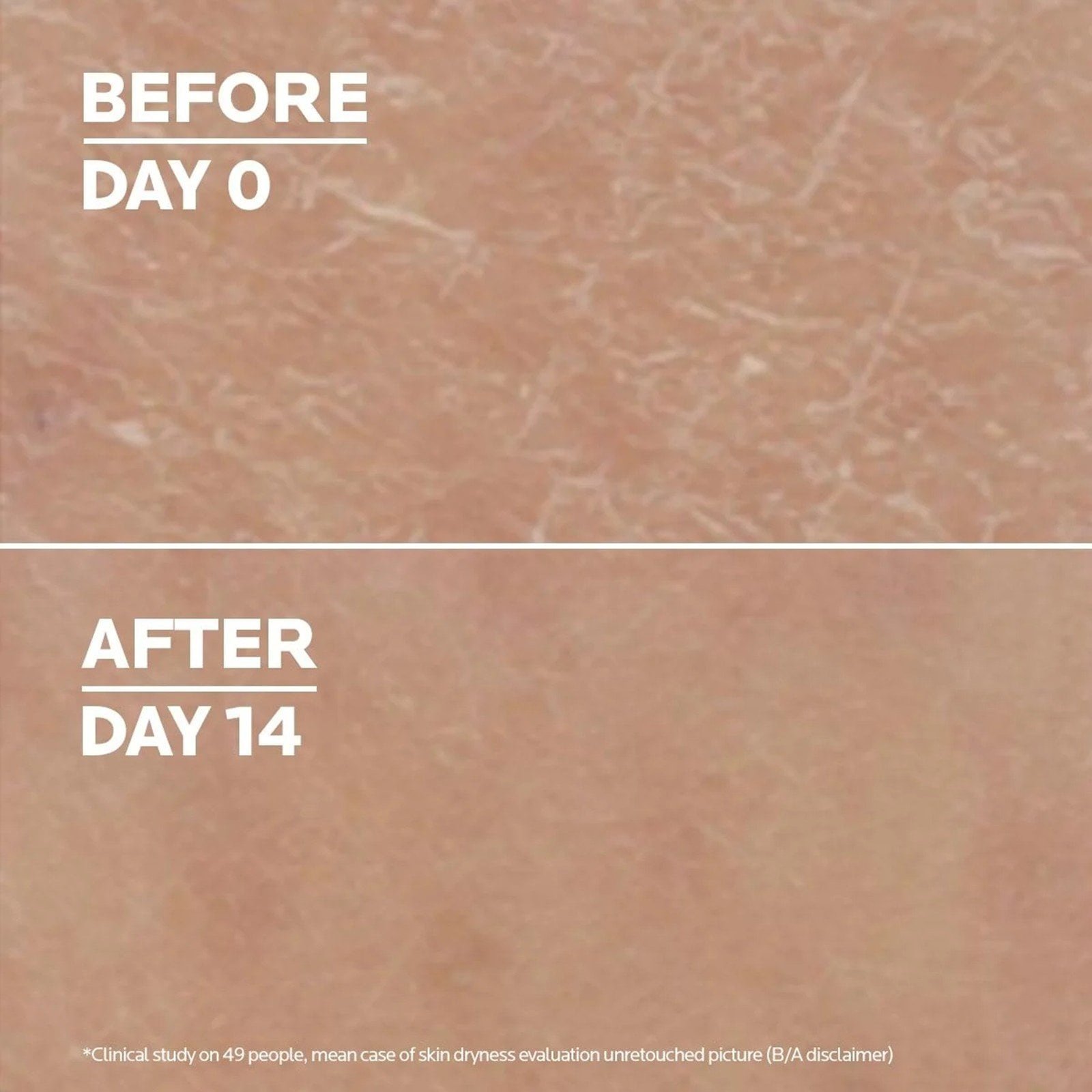 La Roche-Posay Lipikar Lait Urea 10% Triple-Action Hydrating Lotion 400ml