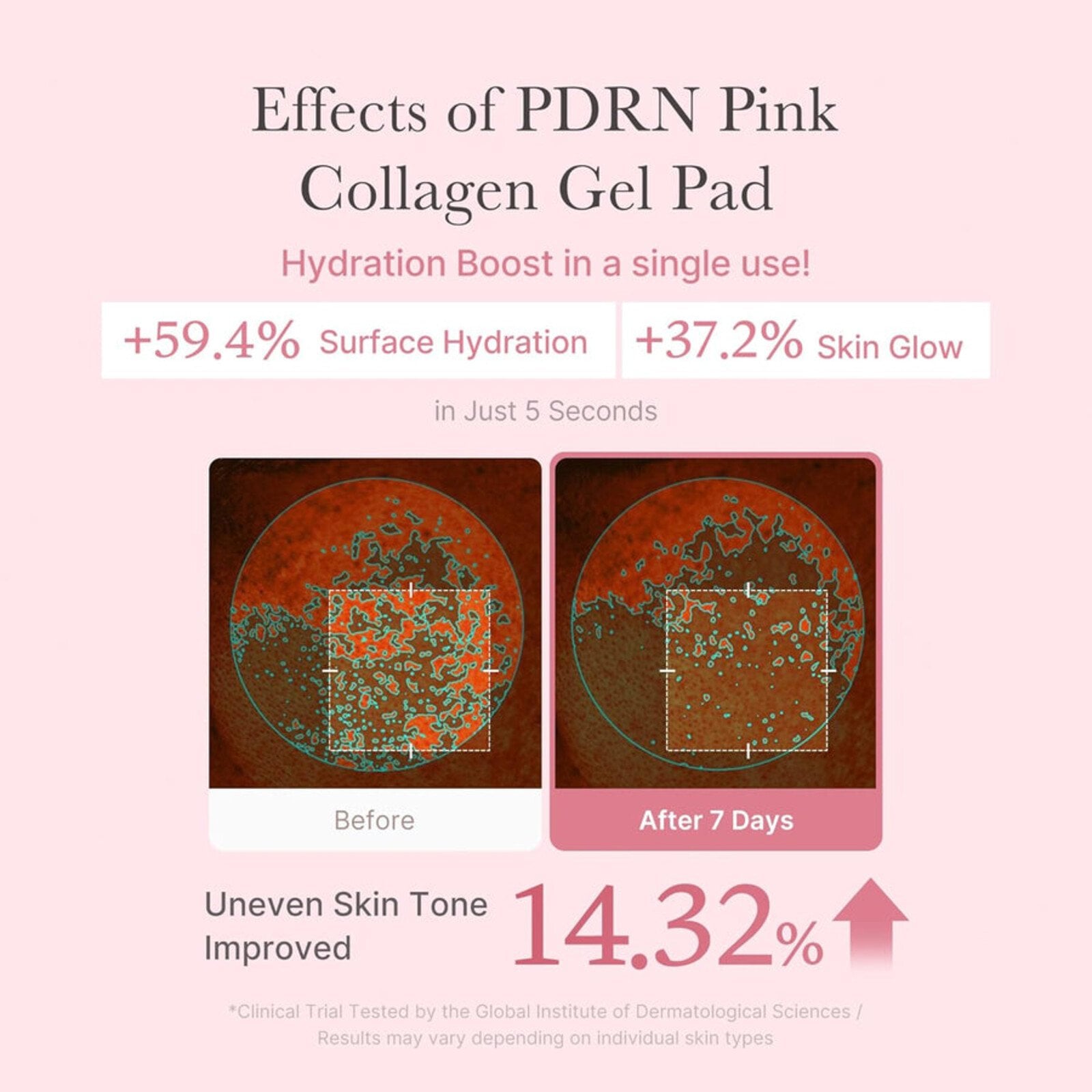 Medicube PDRN Pink Collagen Toning Gel Toner Pad x70