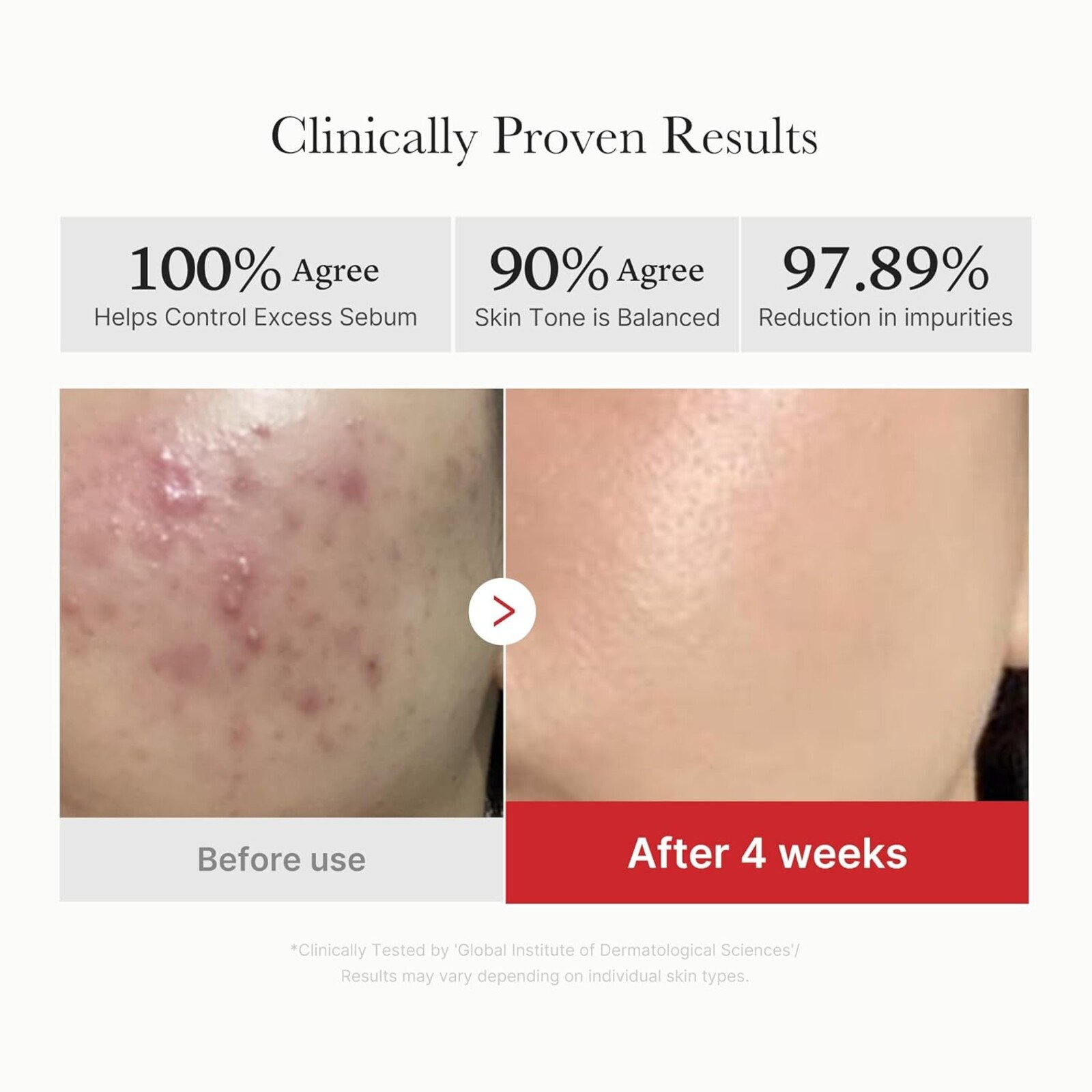 Medicube Red Succinic Acid Peeling Pad x70