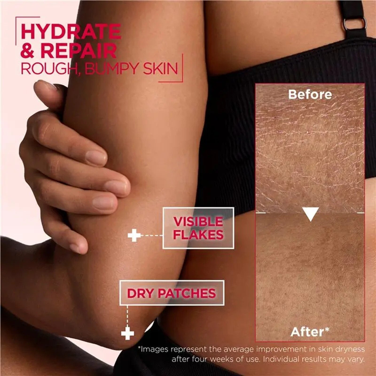 Mixa Urea Cica Repair+ Renewing Cream 400ml