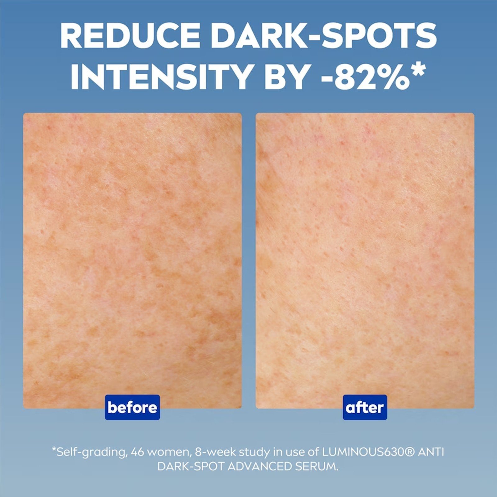 Nivea Luminous 630 Anti-Dark Spots Advanced Serum 30ml