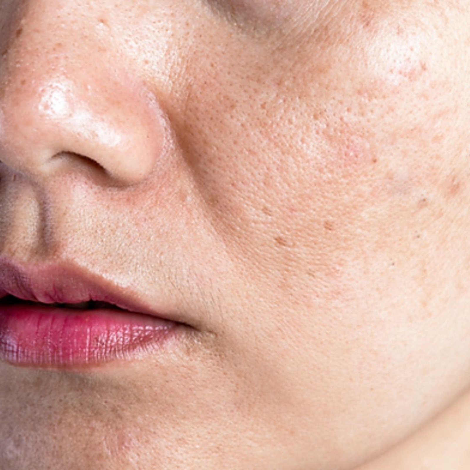 RVB LAB Meso Fill Peel & Bright Tri-Acid Micro-Peel 50ml