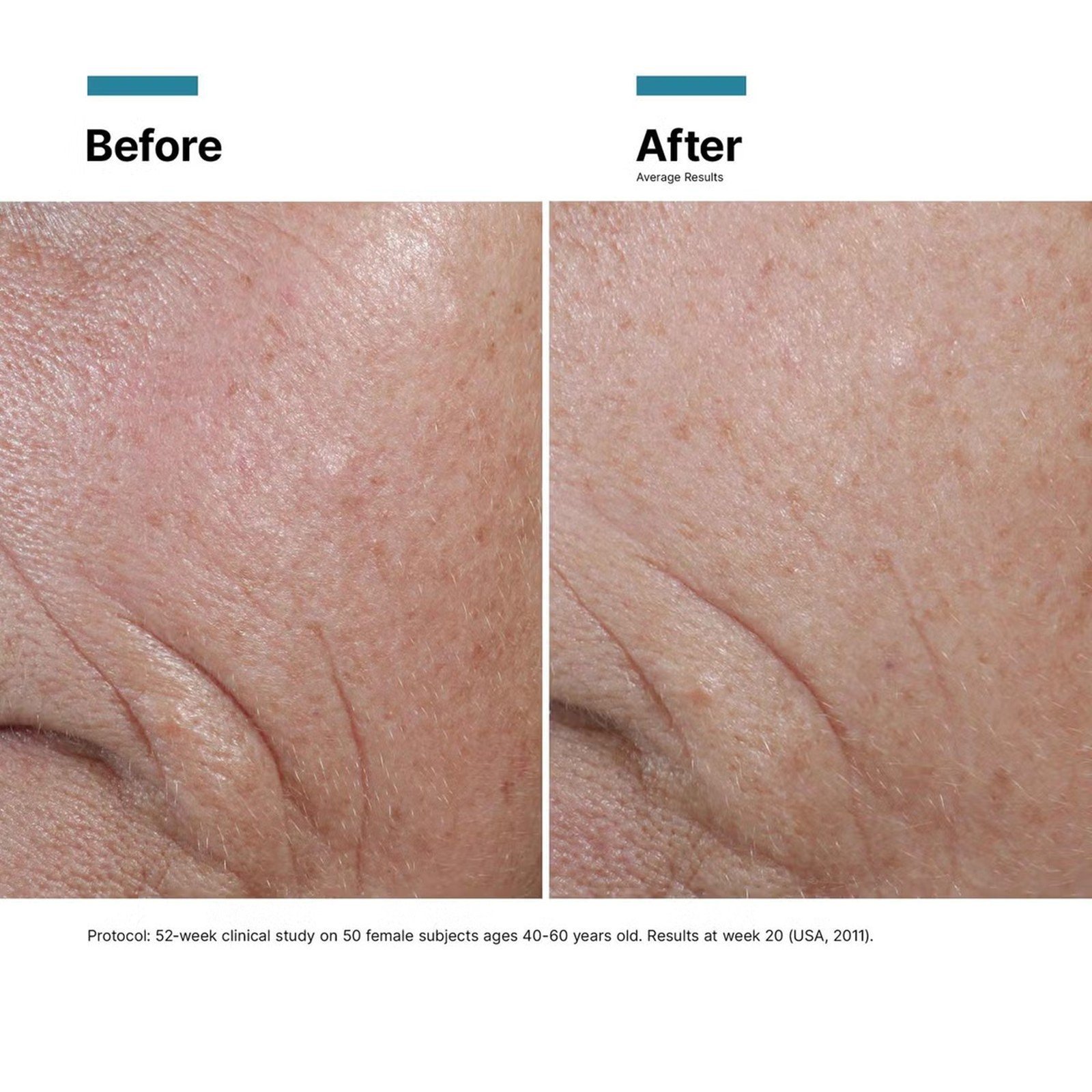 SkinCeuticals Prevent C E Ferulic 30ml