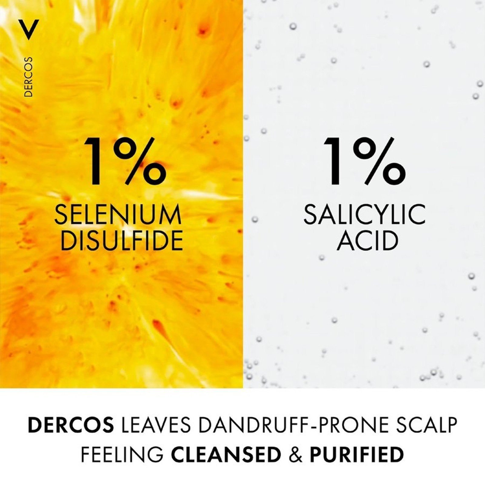 Vichy Dercos Anti-Dandruff DS Shampoo for Normal to Oily Hair 390ml
