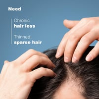 Ducray Anaphase Anti-Hair Loss & Anti-Thinning Shampoo 400ml