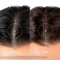Klorane Strengthening Shampoo for Hair Loss & Thinning 400ml (13.53floz)