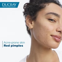 Ducray Keracnyl PP+ Anti-Blemish Cream 30ml