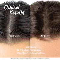Klorane Anti-Hair Loss Serum 100ml