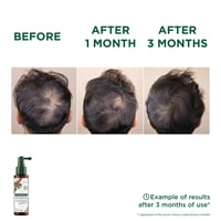 Klorane Anti-Hair Loss Serum 100ml