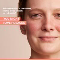 Avène Antirougeurs Rosamed Chronic Redness Concentrate Cream 30ml (1.01floz)