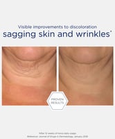 NeoStrata Skin Active Triple Firming Neck Cream 80g (2.82oz)