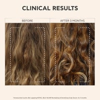 APIVITA Royal Jelly Elixir Revitalizing & Densifying Scalp Serum 50ml