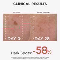 APIVITA C15 Propolis Correct Serum 30ml