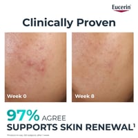 Eucerin DERMOPURE Clinical Peeling 10 40ml