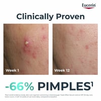 Eucerin DERMOPURE Oil Control Triple Effect Serum 40ml