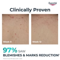 Eucerin DERMOPURE Clinical Correcting Body Care 200ml