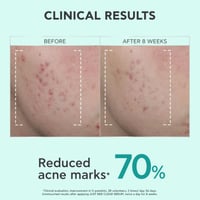 APIVITA Just Bee Clear Refining Serum 30ml