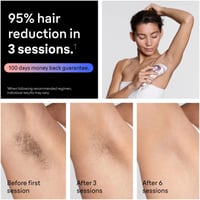 Braun Skin i-Expert Smart IPL Hair Removal System PL7211