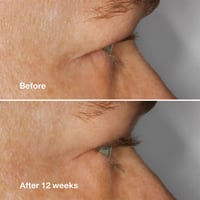 Clinique High Impact Lash Amplifying Serum 3g