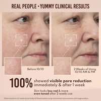 Danessa Myricks Beauty Yummy Skin 10/10 Barrier Boost Hyaluronic Acid + Ectoin Plumping Serum 50ml