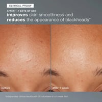 Dermologica Daily Microfoliant Exfoliator 40g (1.4oz)