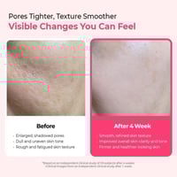 Dr.Melaxin Calcium Cemenrete Cyano Pink Spicule Serum 30ml (1.01floz)