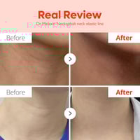 Dr.Melaxin Necksphalt ECM Ceramide Neck Serum 1.5ml x10