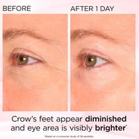 Elizabeth Arden Retinol + HPR Ceramide Rapid Skin Renewing Eye Cream 15ml (0.5floz)