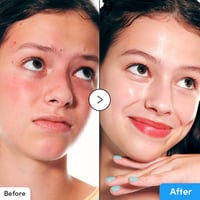 Eqqualberry Blue Blow Hyaluron Flooding Serum 30ml