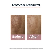 Eucerin Anti-Pigment Dual Serum 30ml