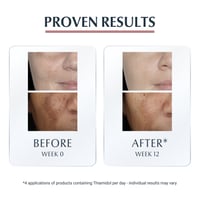 Eucerin Anti-Pigment Spot Corrector 5ml