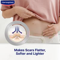 Hansaplast Scar Reducer XL Self-Adhesive Patches x21