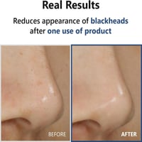 Isntree Hyper ACID4 30 Serum 20ml