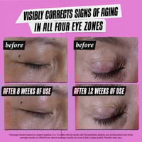 Kiehl's Super Multi-Corrective Eye Zone Treatment 28ml