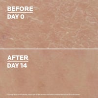 La Roche-Posay Lipikar Lait Urea 10% Triple-Action Hydrating Lotion 400ml