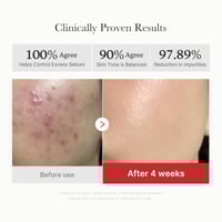 Medicube Red Succinic Acid Peeling Pad x70