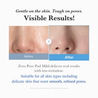 Medicube Zero Pore Pad Mild x70