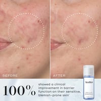 Medik8 Press & Clear Tónico Exfoliante 2% BHA 30ml