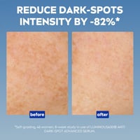 Nivea Luminous 630 Anti-Dark Spots Advanced Serum 30ml