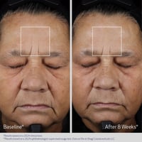 Obagi Elastiderm Advanced Filler Concentrate 20ml