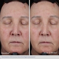 Obagi Elastiderm Lift Up & Sculpt Facial Moisturizer 50ml