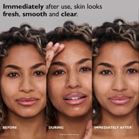 Peter Thomas Roth FIRMx® Peeling Gel 30ml