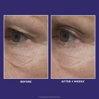 Peter Thomas Roth Ultimate Solution 5™ Multitasking Eye Cream 15ml (0.5floz)